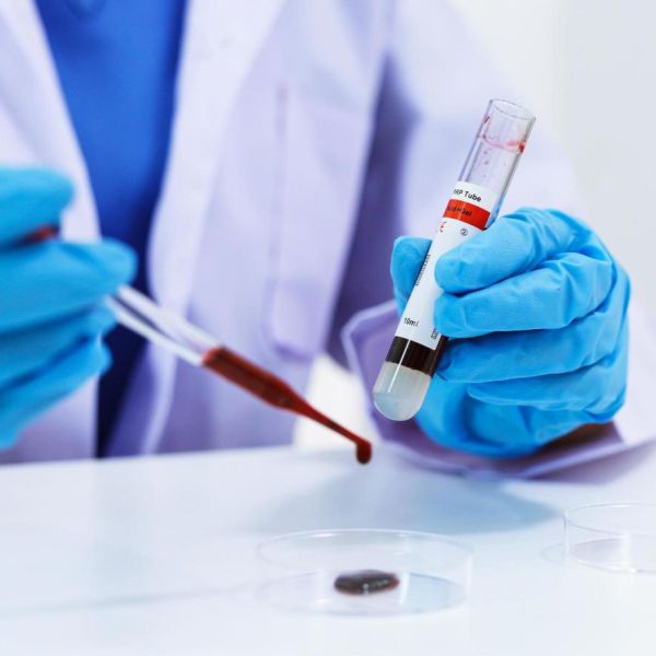 Medical Lab CRP