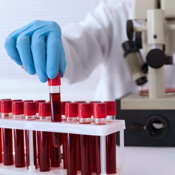 Medical Lab Profil lipidowy